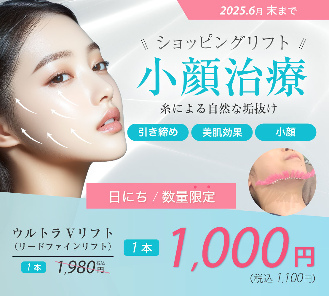 【キャンペーン】リフト