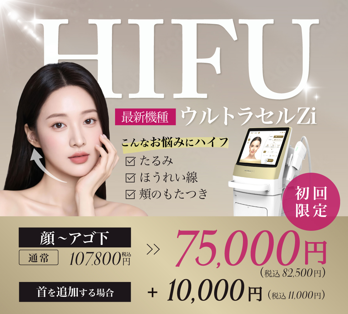 【キャンペーン】ハイフ ウルトラセルZiのバナー