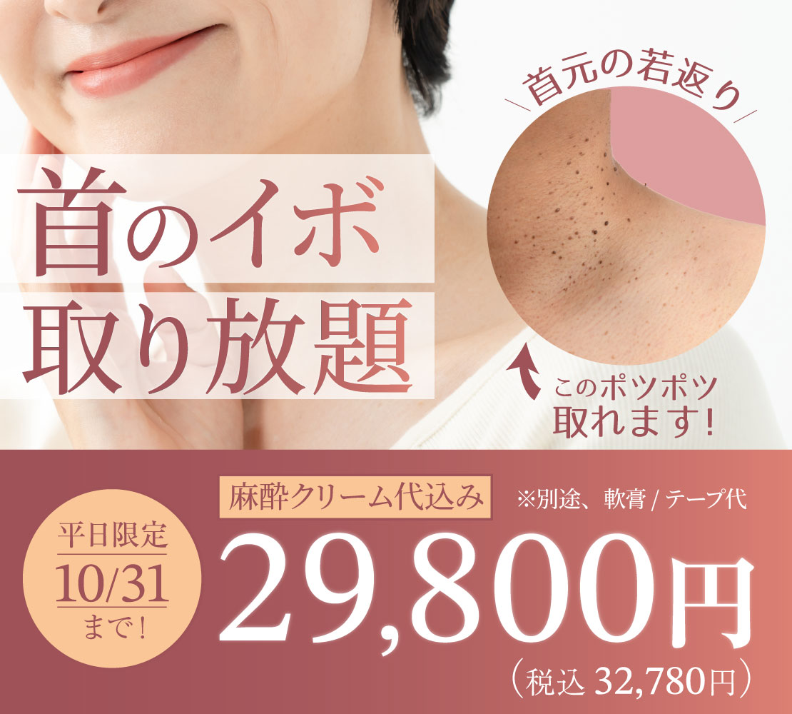 【キャンペーン】首のイボ 取り放題のバナー