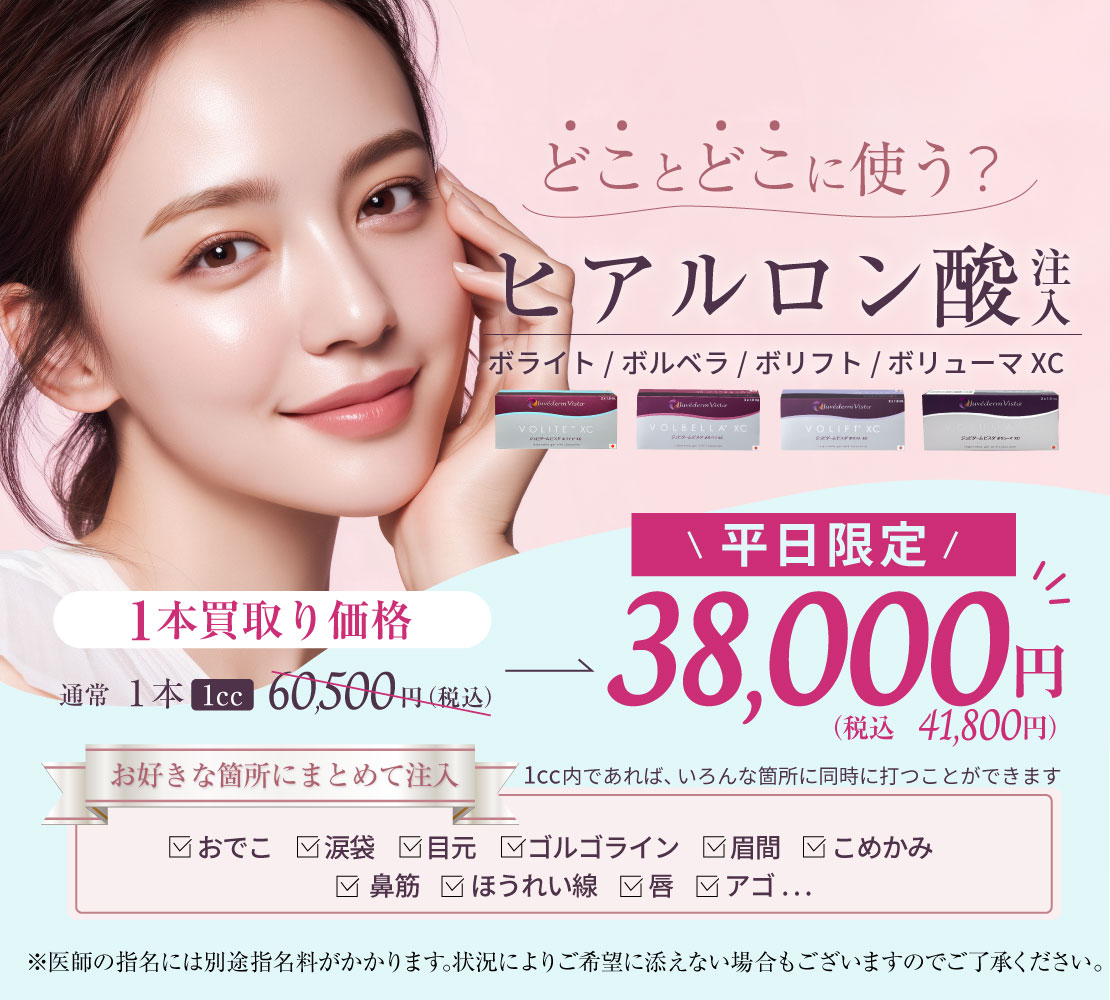 【キャンペーン】ヒアルロン酸注入