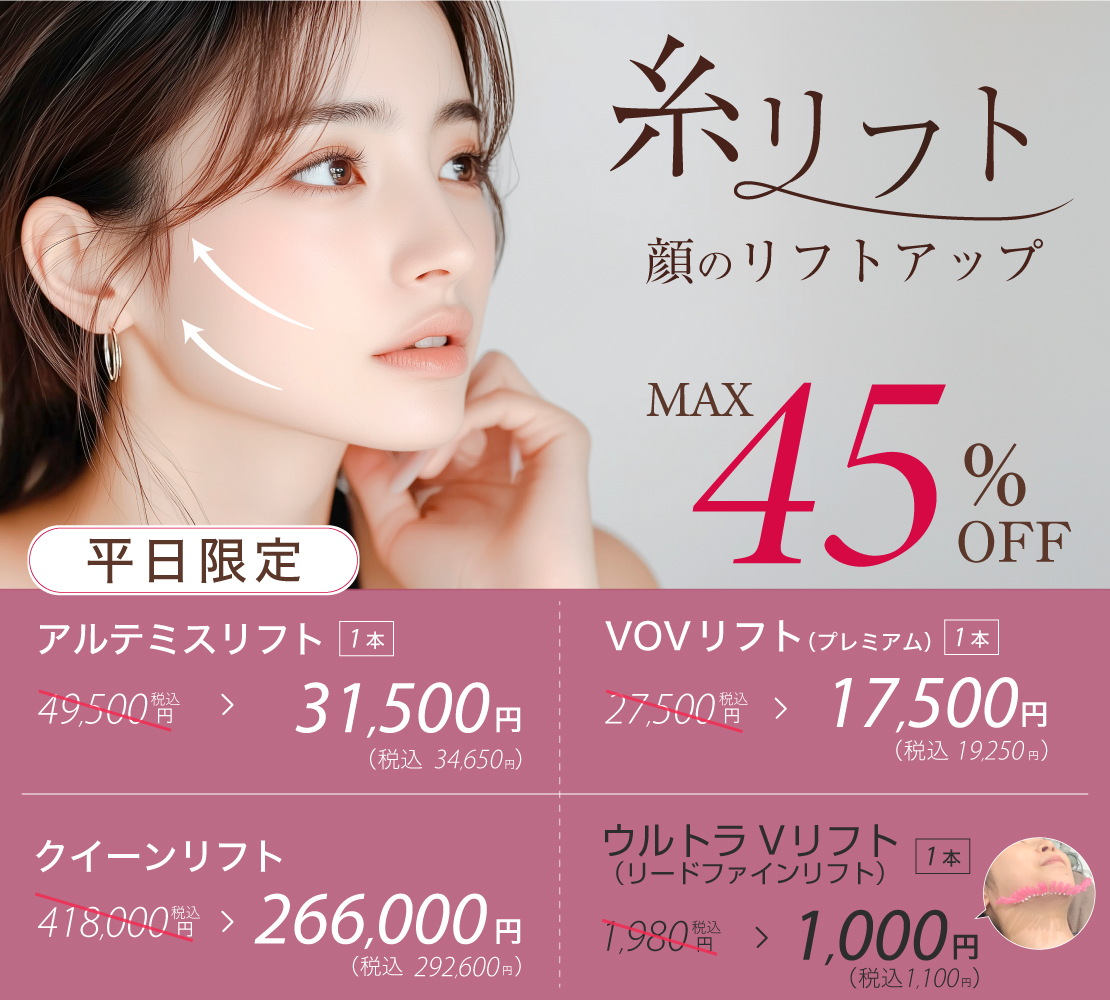 【キャンペーン】糸リフトのバナー