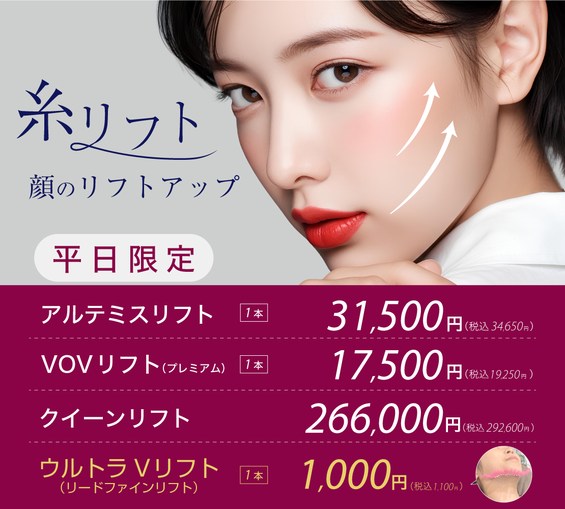 【キャンペーン】糸リフトのバナー