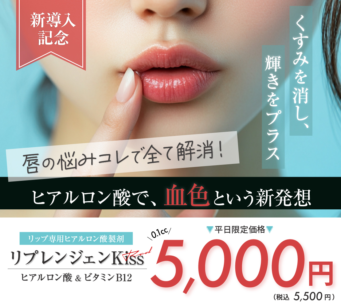 【新導入】【キャンペーン】リプレンジェンKiss