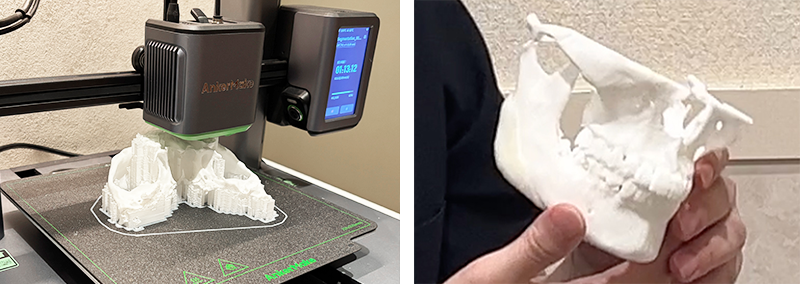 3Dプリンターで出力した実体モデルの写真