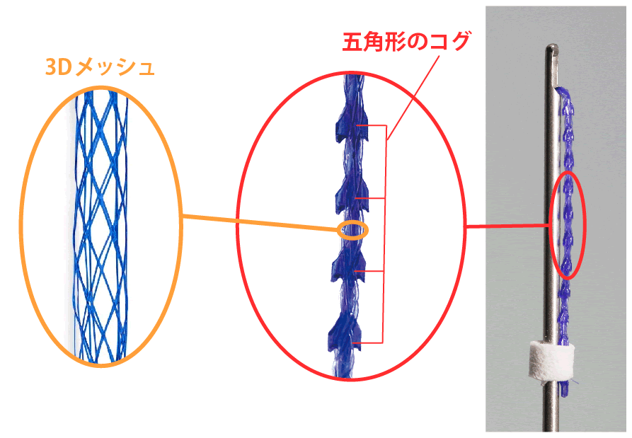 強力なリフトアップ効果の図解