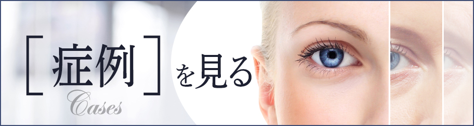 症例を見る