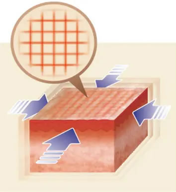 GFRの照射面を格子状にしてエネルギー照射の図解