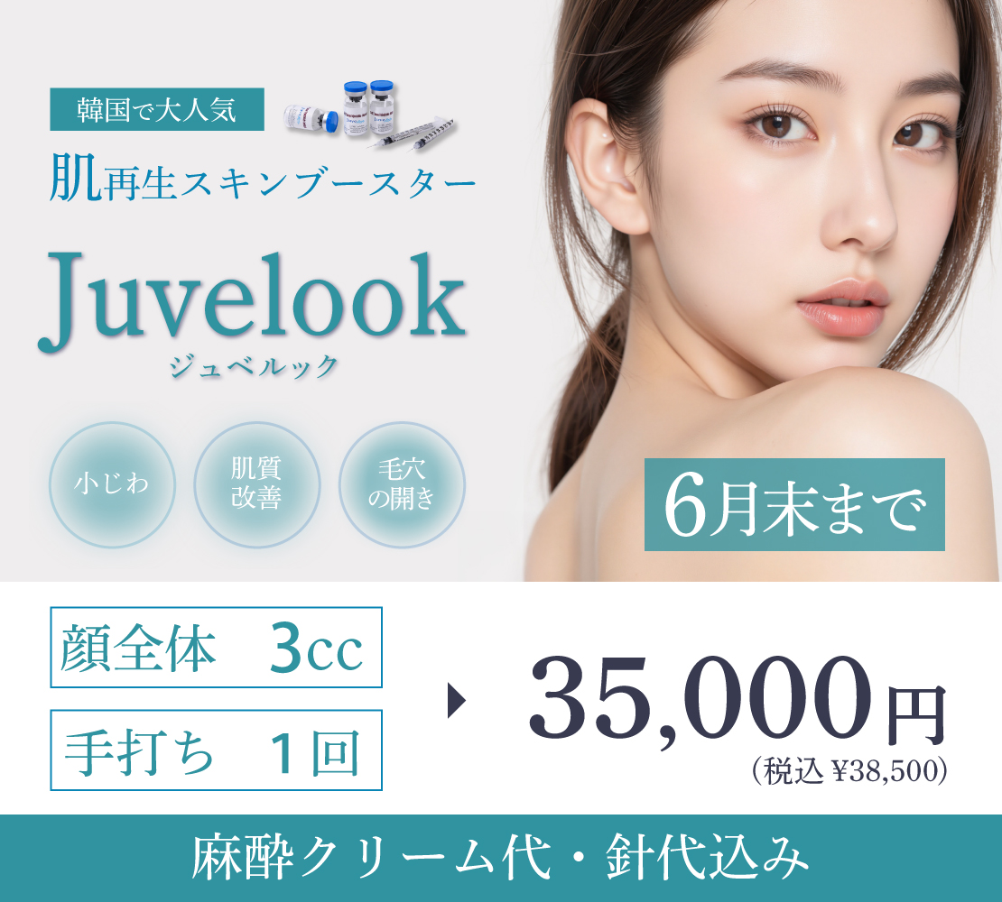 【キャンペーン】ジュベルック