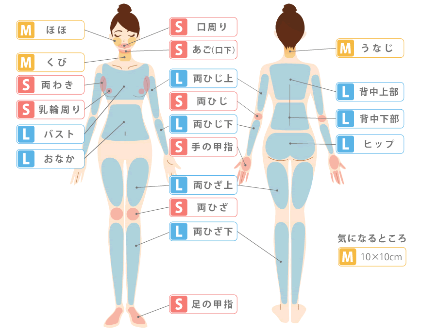 女性のSMLパーツ脱毛（施術部位）図解1