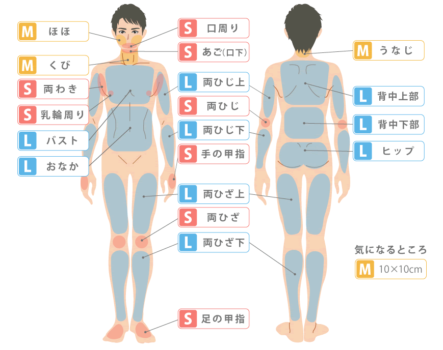 男性のSMLパーツ脱毛（施術部位）図解1